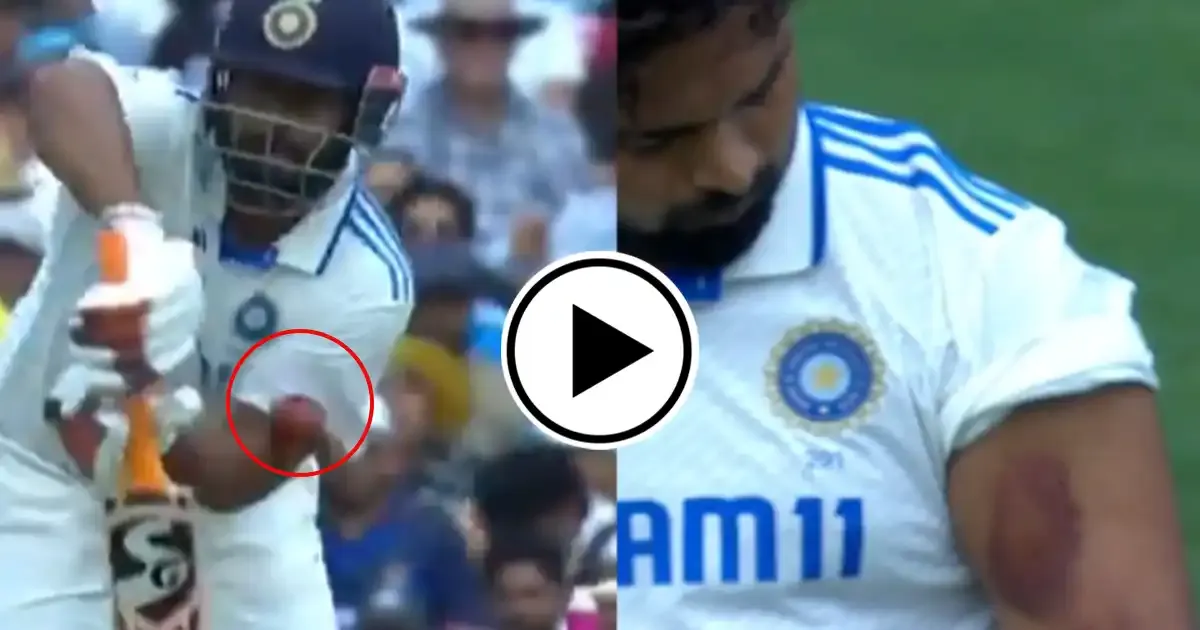 rishabh pant takes body blows replies with massive six in scg test